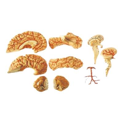 China Hot Sale Durable Brain Anatomical Model and Corebral Arteries for sale