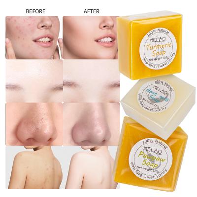 China Wholesale Private Label Skin Care Turmeric Toilet Soap Body Base Cleansing Natural Handmade Facial Massage Cleanser Whitening Acne Facial Soap for sale