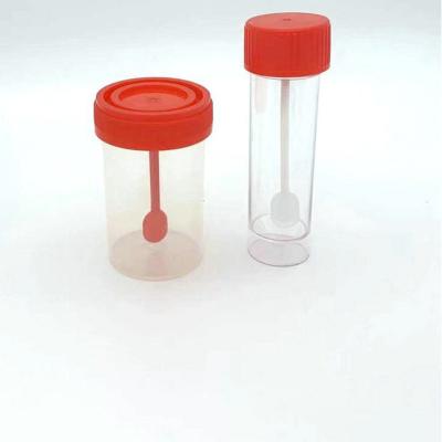 China 30ml 60ml 120ml Disposable Cheap Urine Container Hospital Specimen Cup JDC0030 for sale