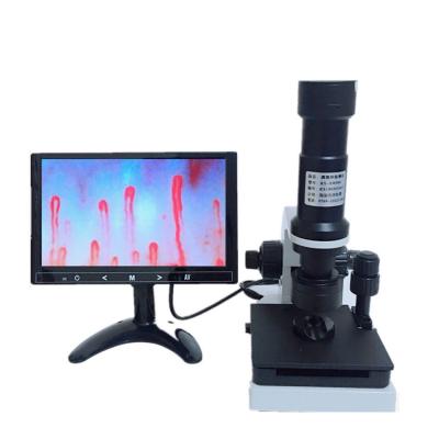 China Finger Circulation Tester Factory Supply TX-XW990 400X Microcirculation Detector Visual Microscope With 9 Inch High Definition Display for sale