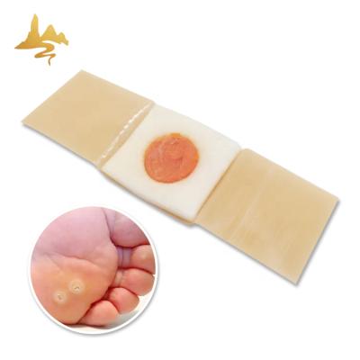 China Action Targeted For Safe And Effective Removal Of Kernels Customized Product Chicken Eye Patch Corn Removal Plaster With CE Certificate for sale