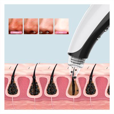 China Black Head Blackhead Remover Button Blackhead Remover Blackhead Remover Hot Spot Remover Vacuum Blackhead Remover Pore Compress Remover Hot New for sale