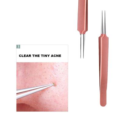 China Hot Selling Face Stainless Steel Blackhead Remover Clamp Tweezers Acne Remover Pointed Clip for sale