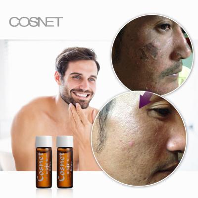 China Anti Aging Face Scar Removal Skin Peeling Serum AHA Lactic Acid for sale