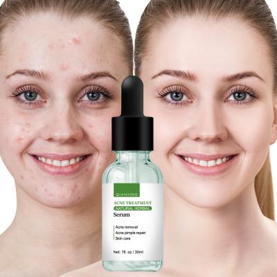 China Skin Revitalizer Private Label Skin Care Repairing Black Prime Remover Tea Tree Acne Treatment AHA Facial Serum for sale