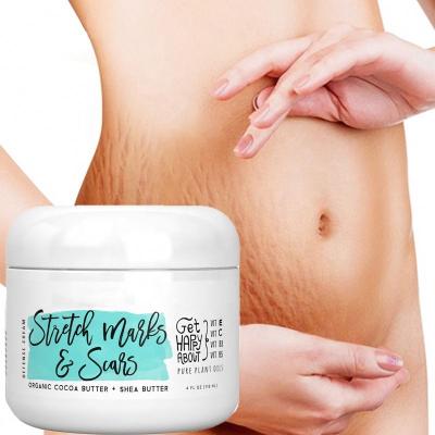 China Custom Natural Organic Mango Belly Reapair Anti Pregnancy Skin Revitalizer Private Label Stretch Marks Removal Cream for sale