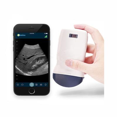 China DIGITAL PORTABLE ULTRASOUND SYSTEM Electronic Array Scanning B B/M Color PDI Medical Ultrasound Machine PDI Mini Wireless Probe Portable Type for sale