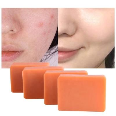 China Basic Cleaning Bath Peel Whitening Soap Bar Kojie San Organic Natural Kojic Acid Soap for sale