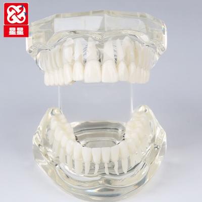 China Detailed anatomy structures demonstration orthodontic model with brackets, arch wires and lingual ligature bonds for sale