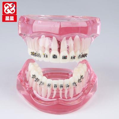 China Hospital Clinic University Orthodontic Demnstration Dental Model With Metal Brackets for sale