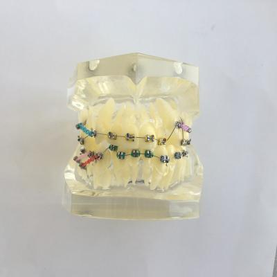 China Vivid orthodontic treatment model for sale