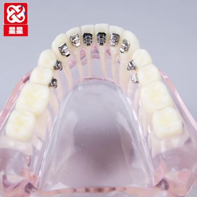 China Transparent vivid orthodontic demonstration dental model with four kinds of roth and side of ceramic Roth Mbt ligual brackets for sale