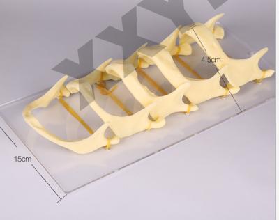 China Detailed Anatomy Structures 5 Grades Degenerated Jaw Dental Model for sale