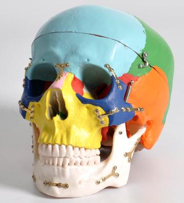 China Detailed Anatomy Structures Adult Colored Skull Anatomical Model For Medical Demonstration With Normal Fracture Part Fixed By Titanium Plate for sale