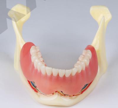 China Detailed anatomy structures denture implant and anatomical restoration jaw model for sale