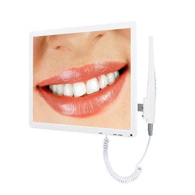 China Dental Regional Oral Endoscope for sale