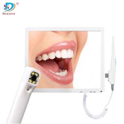 China 1080p dental regional intraoral camera for sale