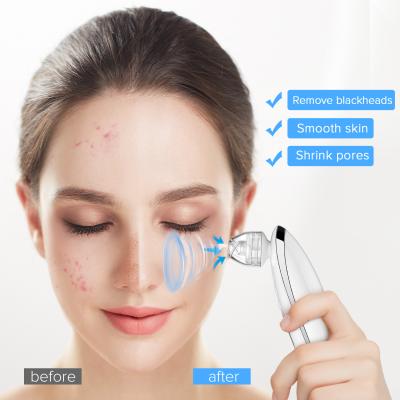 China Hot Selling Acne Treatment Usb Rechargeable Blackhead Remover Pore Vacuum Remove Blackhead Device for sale