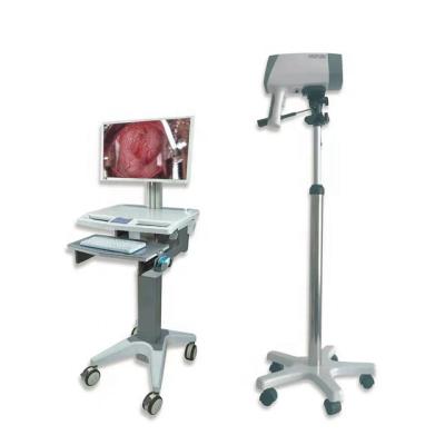 China Metal Gynecological Examination Equipment Digital Video Colposcope for sale