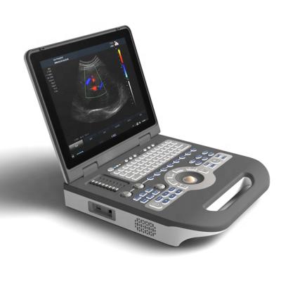 Cina Laptop 4D Echo Ultrasound Scanner Color Doppler Diagnostic in vendita