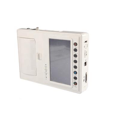 China Portable Metal ECG06A 6 Channel ECG Device Te koop