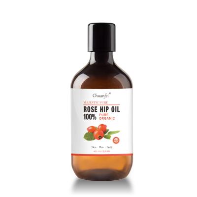 China Baolin 100% Pure Anti Aging Organic Cold Pressed Rosehip Oil OEM Private Label for sale