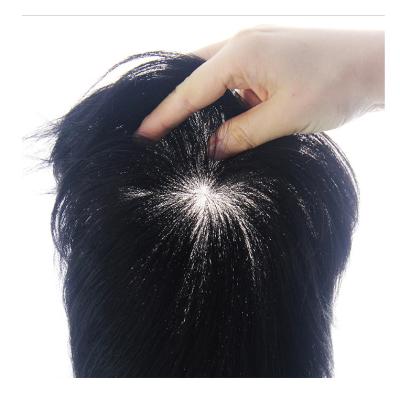 China DHL Men's Natural Hairline Hairpiece Forehead Hairpiece Replacement Block Front Microneedle Scalp Wig Men's Hairpiece ZZ-389 for sale