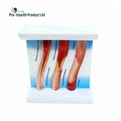 China PP Blood Vessel Dynamic Vascular Educational Teaching Model (Basic) for sale