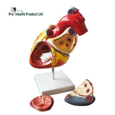 China PVC Double Size Amplification Human Heart In 4 Assemble Parts With Number Remark Education Anatomical Model for sale