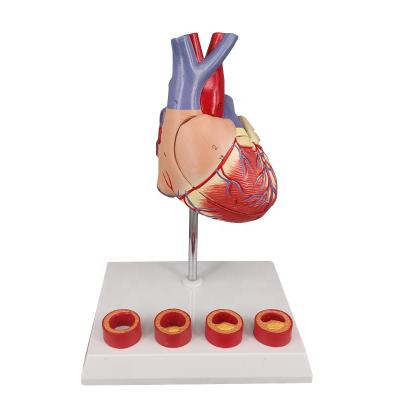 China PVC Plastic Human Atherosclerosis Heart Model For Medical Teaching for sale