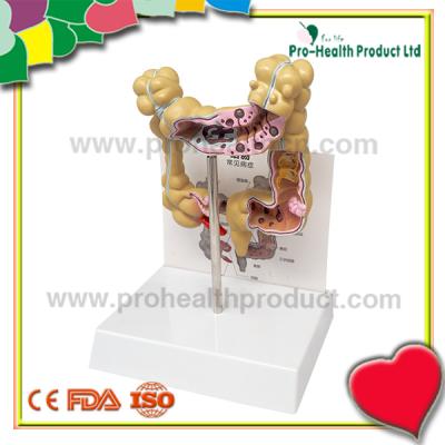 China Intestines Rectum PVC Colon Anatomical Model Of Human Pathology Demonstration Disease for sale