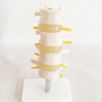 China Section Class Bone Specimen Animal Model Normal Lumbar Spine Tissue Anatomical Model (Four Segments) Hzq-8965 for sale