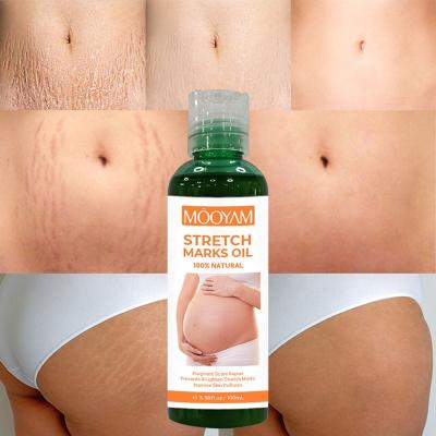 China Best Skin Revitalizer Stretch Marks Remover Oil With Vitamin E Natural Organic Stretch Mark Cream Body Coconut Scar Massage Oil for sale