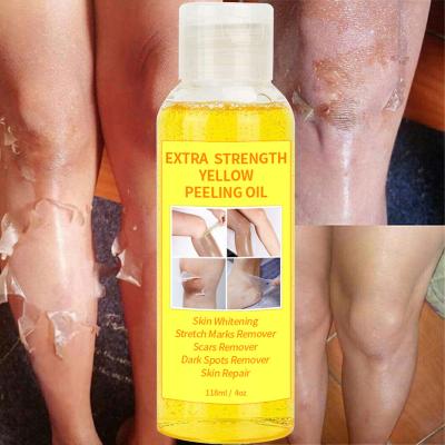 China Yellow Skin Revitalizer OEM Skin Oil Vitamin E Vitamin C Joint Whitening Moisturizing Dark Spot Removal Extra Strength Skin Oil for sale