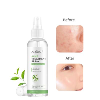 China Portable Acne Toner Glycollic Tea Tree Oil Glycollic Tea Tree Oil Organic Salicylic Acid Toner Acne Face Toner Acne Spray Portable Face Mist Anti Back Acne Spray for sale