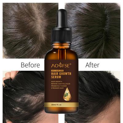 China Private Label Ginger Hair Regrow Oil Natural Hair Growth Serum Herbal Organic Hair Loss Prevention Anti Loss Prevention Hair Loss Treatment for sale