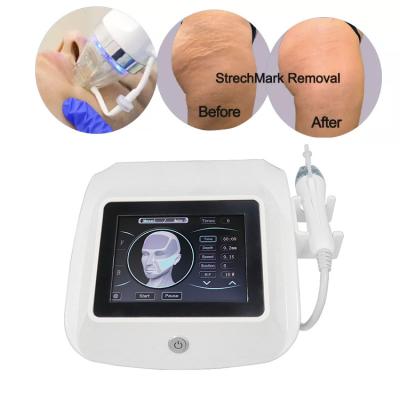 China Wrinkle New Model Fractional Morpheus 8 RF Microneedling Machine Remover / Portable Skin Tightening Radio Frequency Machine for sale