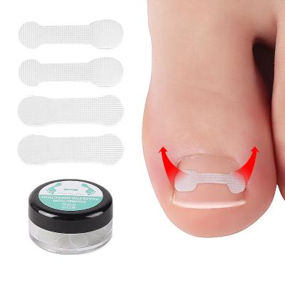 China Pedicure Tools Corrector Foot Tool Toenails Corrector Strips Brace Toe Nail Treatment Patch Resin Nail Glue Sticker Corrector Sticker for sale