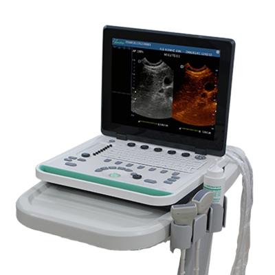 China PC Based Abdomen Laptop B Ultrasound Scanner Machine For Pregnancy OB/GYN & Urology & Cardiology for sale