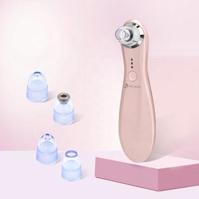 China Acne Treatment USB Charging Camera Treatment Blackhead Remover Facial Cleansing Visual Vacuum for sale