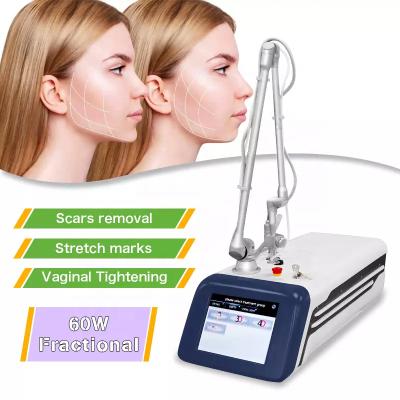 China DPL quick selling hot selling co2 laser scar removal skin rejuvenation fractional co2 laser  fractional laser tighten vagina for sale