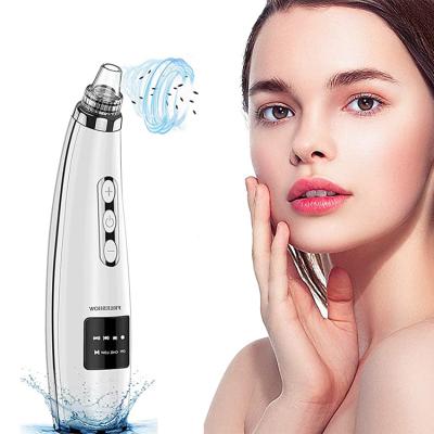 China Black Head Removal 5 in 1 Refillable Facial Pore Nose Pore Remover Blackhead Remover Blackhead Remover Deep Cleansing Vacuum for sale