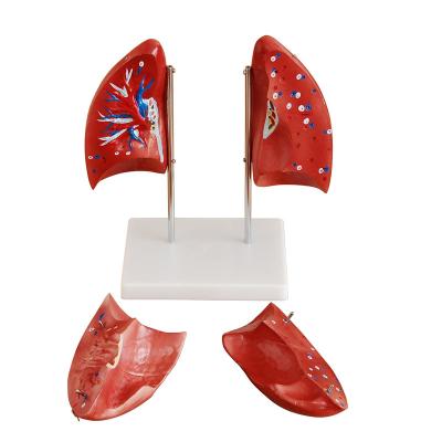 China Left and Right Lungs School Teaching Models Anatomical Model for sale