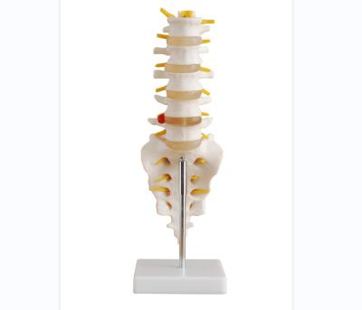 China School Lumbar Vertebra Life-Size Teaching Model with Sacrum and Coccyx and Herniated Disc for sale