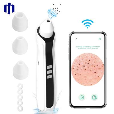 China DEEPLY CLEANING 2021/2022 Best Selling Amazon Blackhead Remover Device, Pore Facial Cleanser With Built-in HD Camera for sale