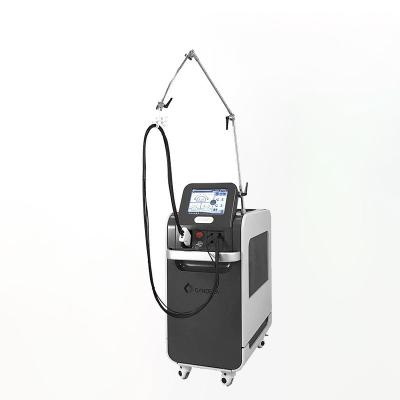 China Dye removal hair removal cadela alexandrite ND yag laser machine alexandrite laser 755nm hair removal equipment for sale