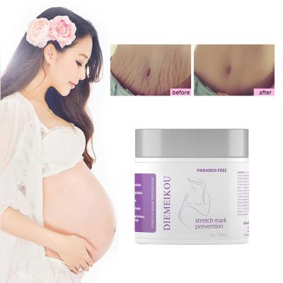 China Moisturizer Private Label Cream for Stretch Mark and Pregnancy Acne Cream Moisturizes Helping Scars and Removing Prevention for sale