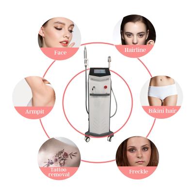 China Stationary Acne Treatment Tattoo 755nm 808 Triple 755 1064 Wavelength Diode Laser Hair Removal System for sale