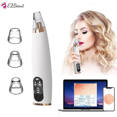 China Ezbeaut Black Head Camera Wireless Visible Skin Rechargeable Electric Microdermabrasion Pore Remover Blackhead Remover With Vacuum Suction for sale