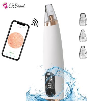 China Custom Electric Logo Visible Wireless Camera Rechargeable Pore Remover Microdermabrasion Vacuum Blackhead Deep Remover Black Head Removal for sale